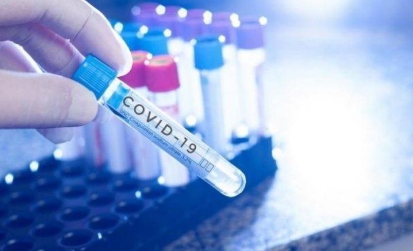 5875 са новите случаи на COVID 19 за последното денонощие Това показват